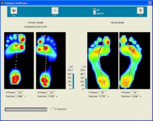 Description: http://www.injuries-clinic-oundle.co.uk/userimages/GAITSCAN%20IMAGES%20007.jpg
